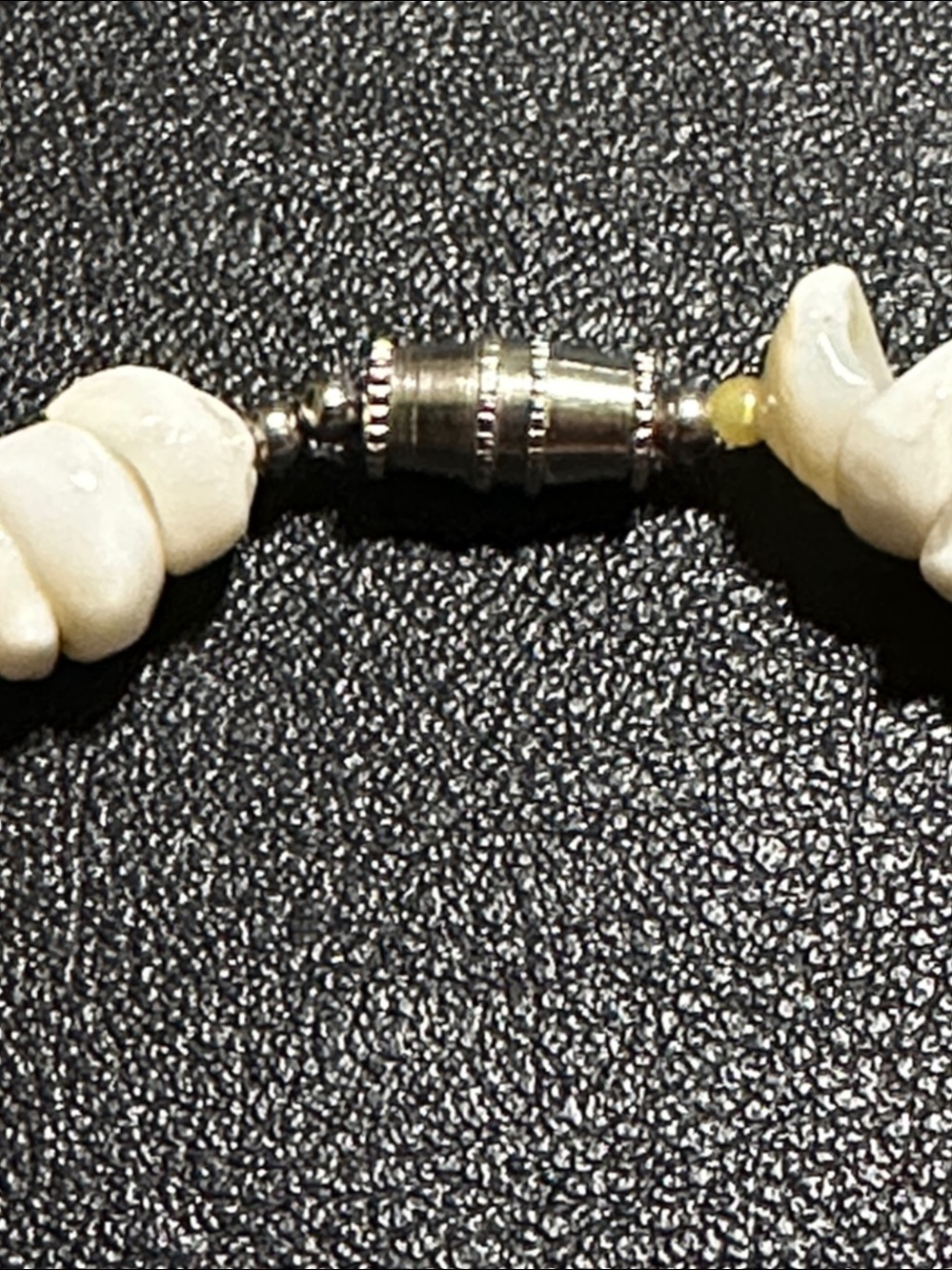 White Puka Shell Vintage Necklace - Picture 3 of 11